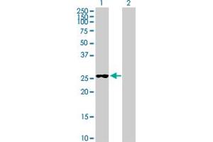 Western Blot analysis of FUBP3 expression in transfected 293T cell line by FUBP3 MaxPab polyclonal antibody. (FUBP3 antibody  (AA 1-261))