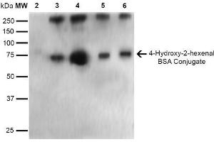 Western Blot analysis of 4-hydroxy-2-hexanal-BSA Conjugate showing detection of 67 kDa 4-hydroxy-2-hexenal-BSA using Mouse Anti-4-hydroxy-2-hexenal Monoclonal Antibody, Clone 6F10 . (4-Hydroxy-2-Hexenal (4-HHE) antibody (Atto 390))