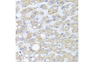 Immunohistochemistry of paraffin-embedded human liver damage using SRI antibody  at dilution of 1:100 (40x lens). (SRI antibody  (AA 1-198))