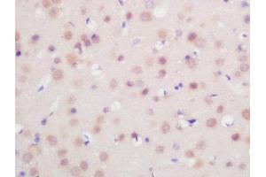 Formalin-fixed and paraffin embedded mouse brain labeled with Rabbit Anti-FoxP1 Polyclonal Antibody, Unconjugated  at 1:200 followed by conjugation to the secondary antibody and DAB staining (FOXP1 antibody  (AA 581-705))