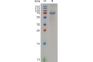 Human B4G, N-hFc Tag on SDS-PAGE under reducing condition. (B4GALT1 Protein (Fc Tag))