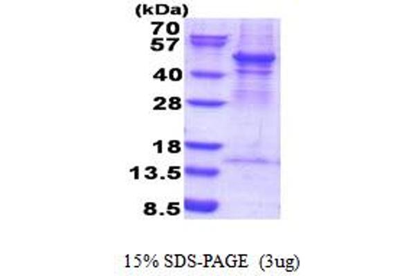 ACTR3 Protein (AA 1-418) (His tag)