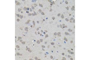Immunohistochemistry of paraffin-embedded rat brain using PPARG antibody (ABIN4904829) at dilution of 1:100 (40x lens). (PPARG antibody)