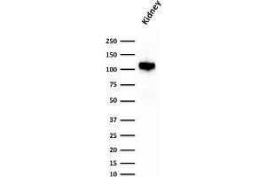 Western Blot Analysis of human Kidney lysate using KSP-Cadherin Rabbit Recombinant Monoclonal Antibody (CDH16/1532R) (Recombinant Cadherin-16 antibody)