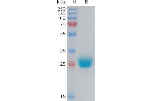 Mouse CXADR Protein, His Tag on SDS-PAGE under reducing condition. (Coxsackie Adenovirus Receptor Protein (AA 20-237) (His tag))