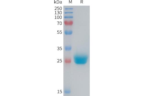 Coxsackie Adenovirus Receptor Protein (AA 20-237) (His tag)