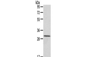 Western Blot analysis of A431 cells using HTATIP2 Polyclonal Antibody at dilution of 1/800 (HIV-1 Tat Interactive Protein 2, 30kDa (HTATIP2) antibody)
