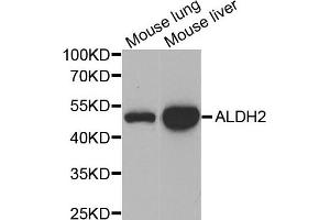 Western blot analysis of extracts of mouse lung and mouse liver  tissues, using ALDH2 antibody. (ALDH2 antibody)