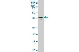 GMPPB monoclonal antibody (M07), clone 2B5 Western Blot analysis of GMPPB expression in HepG2 . (GMPPB antibody  (AA 1-110))