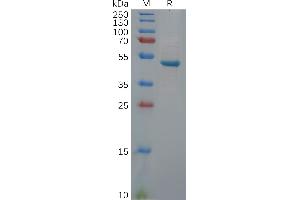 Human U Protein, hFc Tag on SDS-PAGE under reducing condition. (UCHL1 Protein (Fc Tag))