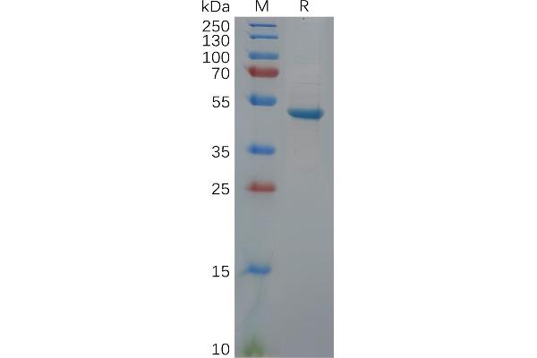 UCHL1 Protein (Fc Tag)