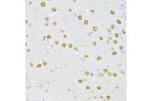 Immunohistochemistry of paraffin-embedded rat brain using SATB1 antibody. (SATB1 antibody)