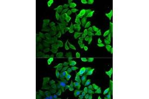 Immunofluorescence analysis of U2OS cells using SEPT2 Polyclonal Antibody (Septin 2 antibody)