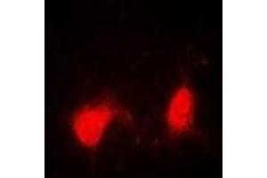 Immunofluorescent analysis of SSNA1 staining in A549 cells. (SSNA1 antibody)