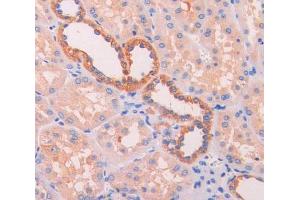 IHC-P analysis of kidney tissue, with DAB staining. (UCP2 antibody  (AA 154-289))