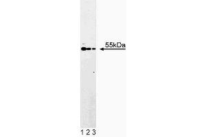 Western blot analysis of ATP Synthase alpha on Jurkat cell lysate. (ATP Synthase alpha (AA 113-220) antibody)