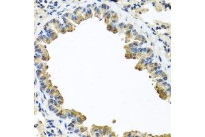 Immunohistochemistry of paraffin-embedded mouse lung using SERPINA3 antibody. (SERPINA3 antibody  (AA 24-423))