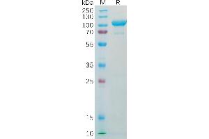 Human AFP Protein, hFc Tag on SDS-PAGE under reducing condition. (alpha Fetoprotein Protein (AA 19-609) (Fc Tag))