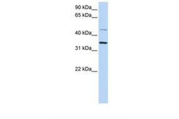 CLN6 antibody  (C-Term)