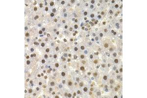 Immunohistochemistry of paraffin-embedded rat liver using TOR1A antibody. (TOR1A antibody)