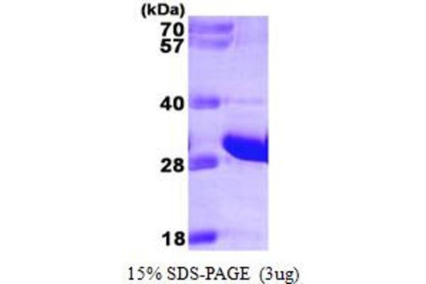 FADD Protein (AA 1-208) (His tag)