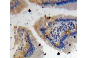 Used in DAB staining on fromalin fixed paraffin-embedded Intestine tissue (DEFA4 antibody  (AA 20-92))