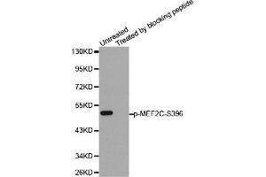 Western Blotting (WB) image for anti-Myocyte Enhancer Factor 2C (MEF2C) (pSer396) antibody (ABIN1870432) (MEF2C antibody  (pSer396))