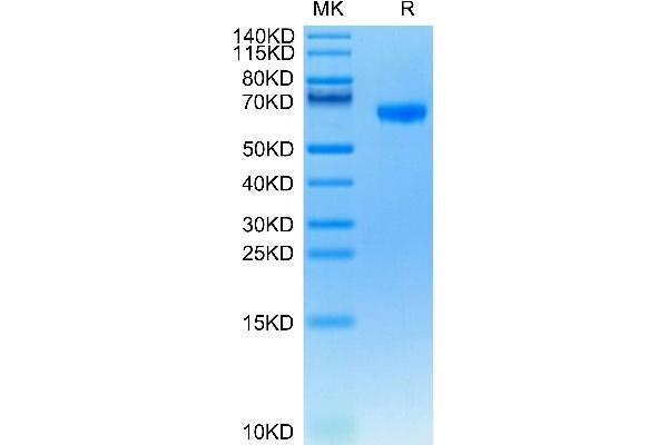 FCRL2 Protein (AA 20-401) (His tag)