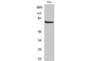 Western Blotting (WB) image for anti-V-Raf-1 Murine Leukemia Viral Oncogene Homolog 1 (RAF1) (pSer338) antibody (ABIN3182404) (RAF1 antibody  (pSer338))