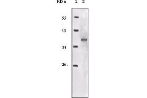 Western Blotting (WB) image for anti-Insulin-Like Growth Factor 1 Receptor (IGF1R) (truncated) antibody (ABIN2464068) (IGF1R antibody  (truncated))