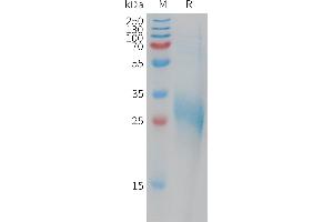 Human CB Protein, His Tag on SDS-PAGE under reducing condition. (C-Type Lectin Domain Family 1, Member B (CLEC1B) (AA 55-229) protein (His tag))