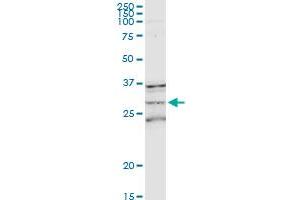 MS4A1 MaxPab rabbit polyclonal antibody. (CD20 antibody  (AA 1-297))