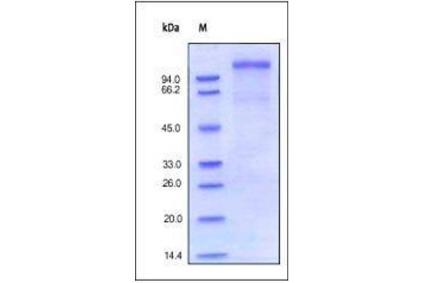 VLDLR Protein (AA 28-769) (His tag)