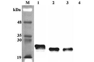 Western blot analysis using anti-Lipocalin-2 (rat), pAb  at 1:4'000 dilution. (Lipocalin 2 antibody)