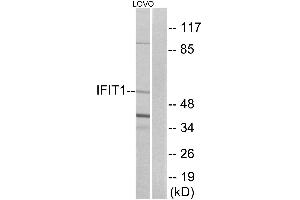 Western blot analysis of extracts from LOVO cells, using IFIT1 antibody. (IFIT1 antibody)