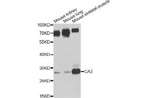 Western blot analysis of extracts of various cell lines, using CA3 antibody (ABIN6292665) at 1:1000 dilution. (CA3 antibody)