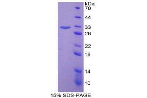 SDS-PAGE (SDS) image for Meprin A, beta (MEP1B) (AA 433-679) protein (His tag) (ABIN2125849) (Meprin B Protein (AA 433-679) (His tag))