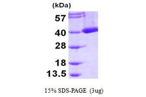 CRYM Protein (AA 1-314) (His tag)