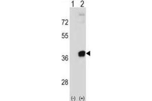 Western Blotting (WB) image for anti-phosphoribosyl Pyrophosphate Synthetase 2 (PRPS2) antibody (ABIN2998735) (PRPS2 antibody)