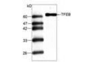 Image no. 1 for anti-Transcription Factor EB (TFEB) antibody (ABIN791477) (TFEB antibody)