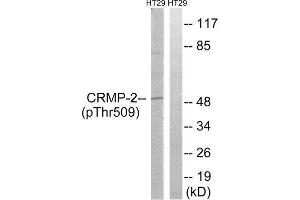 Western Blotting (WB) image for anti-Dihydropyrimidinase-Like 2 (DPYSL2) (pThr509) antibody (ABIN1847761) (DPYSL2 antibody  (pThr509))