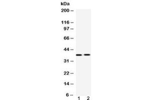 Western blot testing of 1) rat liver and 2) human 22RV1 (prostate carcinoma) lysate with HDGF antibody at 0. (HDGF antibody  (AA 61-97))