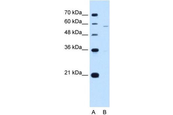 PIGV antibody  (N-Term)