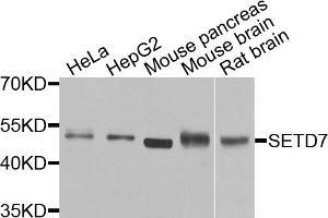 Western blot analysis of extracts of various cell lines, using SETD7 antibody. (SETD7 antibody)