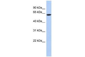 CAMKV antibody used at 1 ug/ml to detect target protein. (CAMKV antibody  (N-Term))