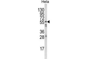 Western Blotting (WB) image for anti-FYN Oncogene Related To SRC, FGR, YES (FYN) antibody (ABIN3003446) (FYN antibody)