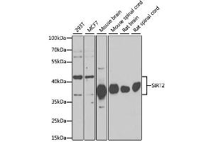 Western blot analysis of extracts of various cell lines, using SIRT2 antibody. (SIRT2 antibody)