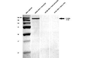 Western Blot analysis of Human HEK-T lysates showing detection of GluN2B/NR2B protein using Mouse Anti-GluN2B/NR2B Monoclonal Antibody, Clone S59-36 . (GRIN2B antibody  (AA 20-271) (FITC))
