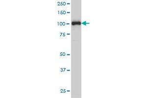 Western Blotting (WB) image for anti-Progesterone Receptor (PGR) (AA 1-111) antibody (ABIN598869) (Progesterone Receptor antibody  (AA 1-111))