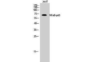 Western Blotting (WB) image for anti-Nuclear Factor-kB p65 (NFkBP65) (Thr735) antibody (ABIN3185890) (NF-kB p65 antibody  (Thr735))